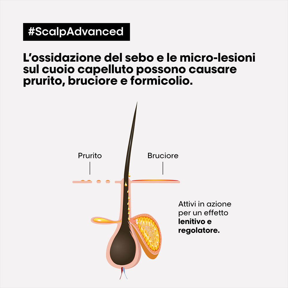 L'Oreal Professionnel Paris Scalp Advanced Anti-Discomfort Shampoo 500ml
